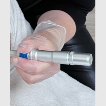 DermaGlow Duo: Microneedling & BB glow