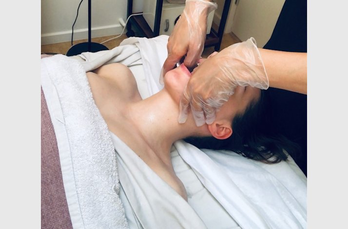Intra Buccal Face Lifting : Odense: torsdag den 2 oktober  2025, kl. 10-17:00